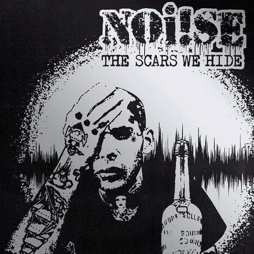 Noise: Scars We Hide